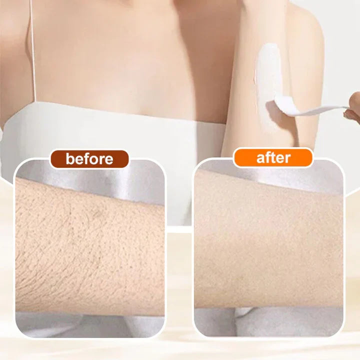 Hair Erase – Gentle Hair Removal Cream